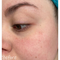 تونر آیم فرام Rice