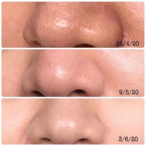 سرم اوردینری Niacinamide