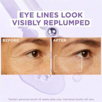 سرم ضد چروک لورآل Revitalift Filler