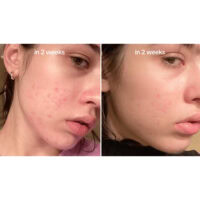 سرم ضد لک و روشن‌کننده آنوا