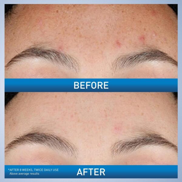 سرم سراوی RESURFACING RETINOL