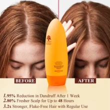 شامپو ضدشوره آرگان میداس anti dandruff
