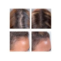 کپسول ضد ریزش مو پریورین