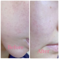 تونر ترمیم کننده سام بای می BETA PANTHENOL