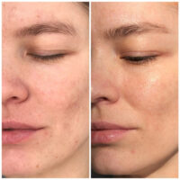 سرم ویتامین C سام بای می GALACTOMYCES