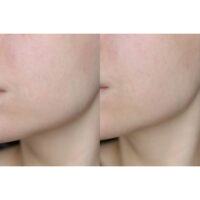 سرم ویتامین C سام بای می GALACTOMYCES