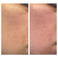 کیت 4 عددی مراقبت از پوست سام بای می