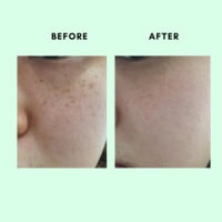 کیت 4 عددی مراقبت از پوست سام بای می