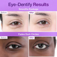 پچ زیر چشم و کلاژن شماره 9 نامبوزین +NAD