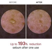 آمپول لایه بردار برنج سیاه دکتر ملاکسین Peel Shot Exfoliant