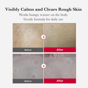 خرید اسپری لایه بردار و ضدجوش بدن مدی کیوب Red Acne حجم 110