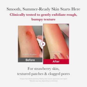 اسپری لایه بردار و ضدجوش بدن مدی کیوب Red Acne حجم 110