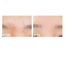 خرید سرم روشن کننده بیوتی اف جوسان PROPOLIS + NIACINAMIDE حجم 30