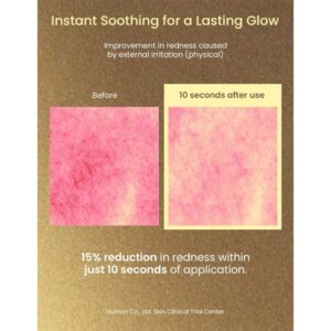خرید تونر ضد لک و درخشان کننده اکسیس وای Dark Spot Correcting حجم 125 میل