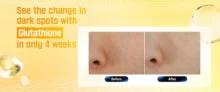 کرم ضد لک و روشن کننده شماره 5 نامبوزین Glutathione