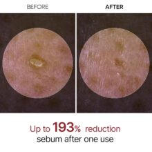 آمپول لایه بردار برنج سیاه دکتر ملاکسین Peel Shot Exfoliant