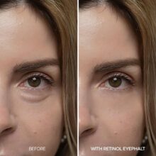کرم دور چشم دکتر ملاکسین Eyephalt Retinol