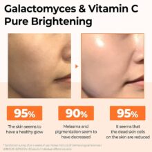 سرم ویتامین C سام بای می GALACTOMYCES