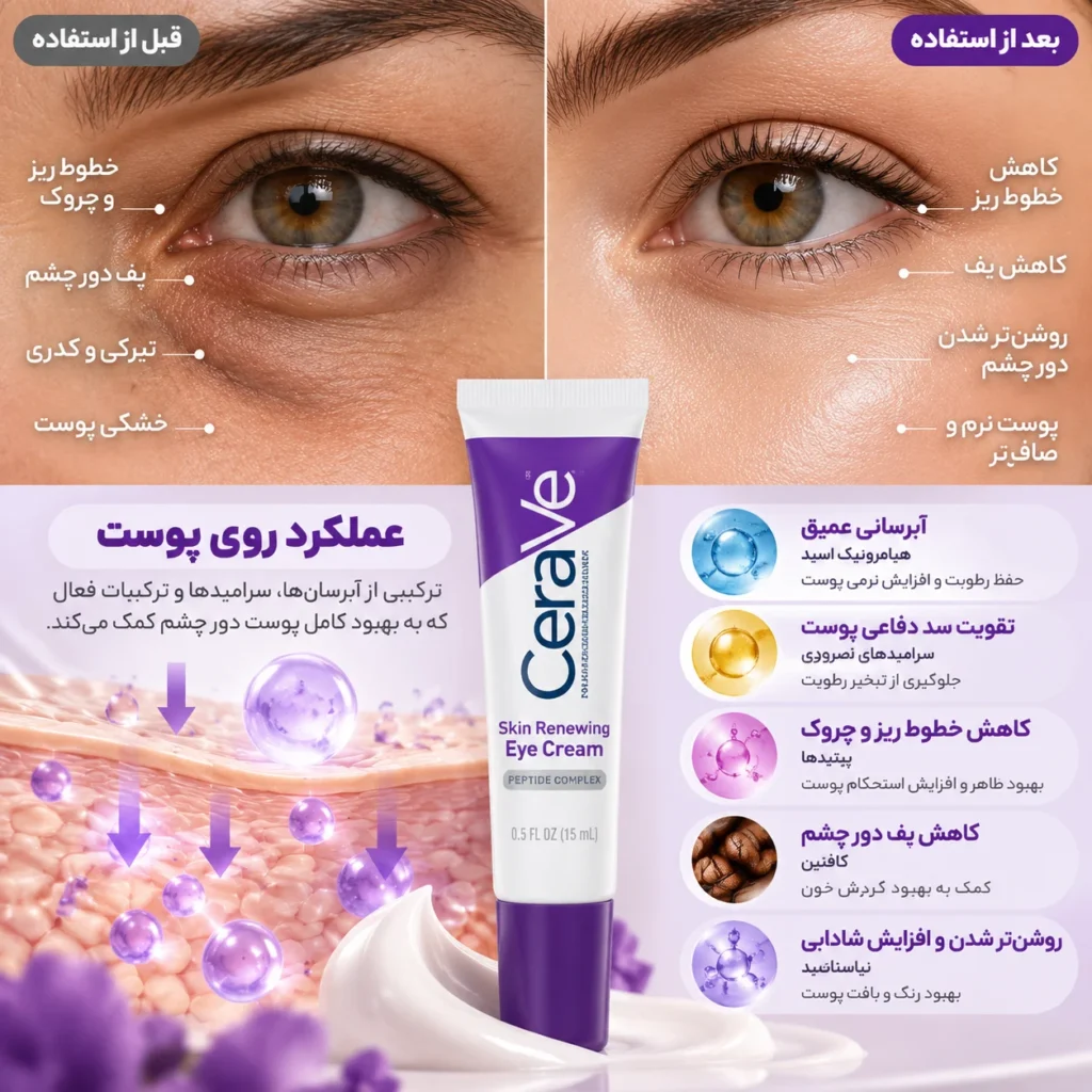 کرم دور چشم ضد چروک و بازسازی کننده سراوی Skin Renewing Eye Cream حجم 14.2 گرم؛ آبرسان، جوانساز و تقویت‌کننده پوست دور چشم