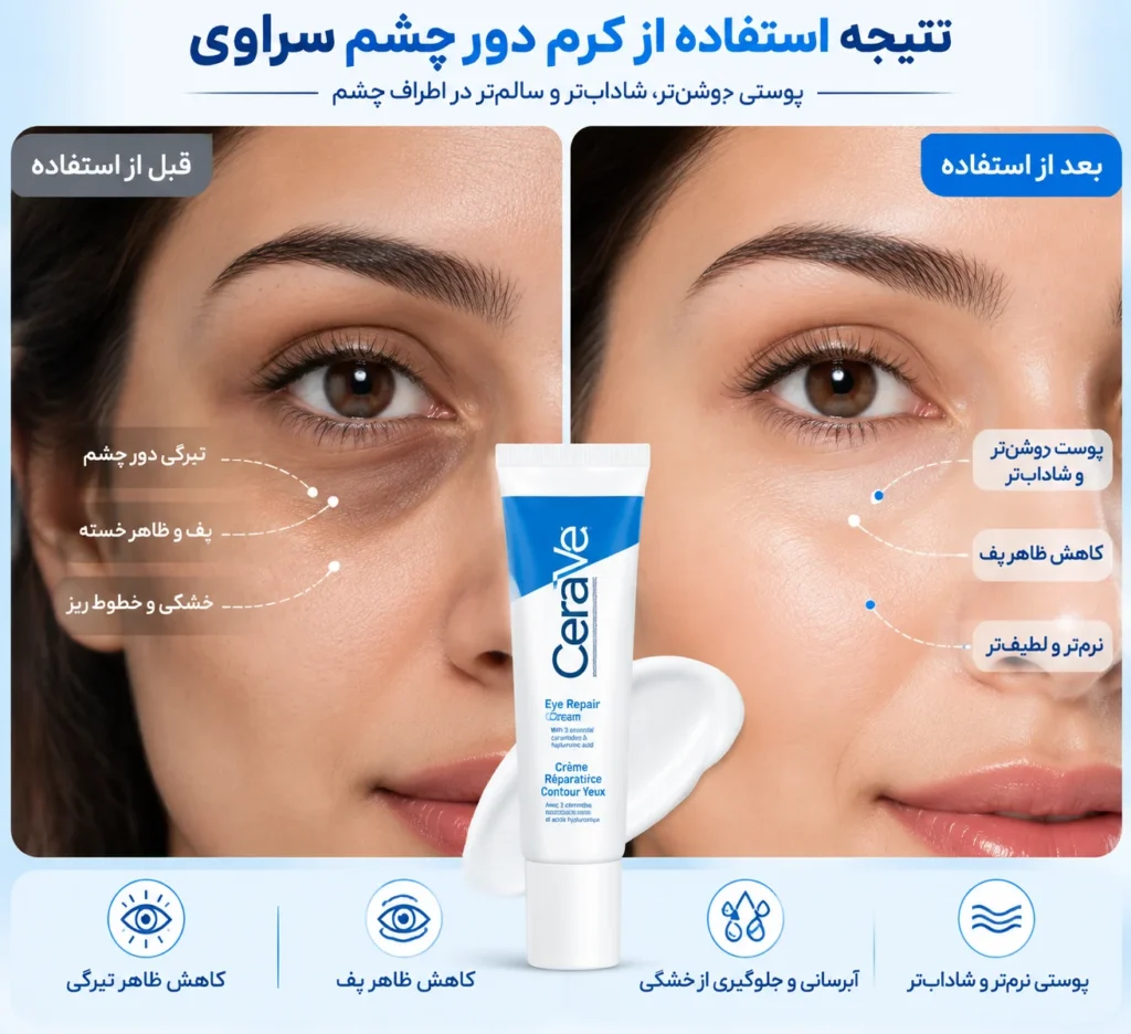 کرم دور چشم ترمیم کننده سراوی CeraVe Eye Repair Cream؛ آبرسان، روشن‌کننده و تقویت‌کننده پوست حساس اطراف چشم