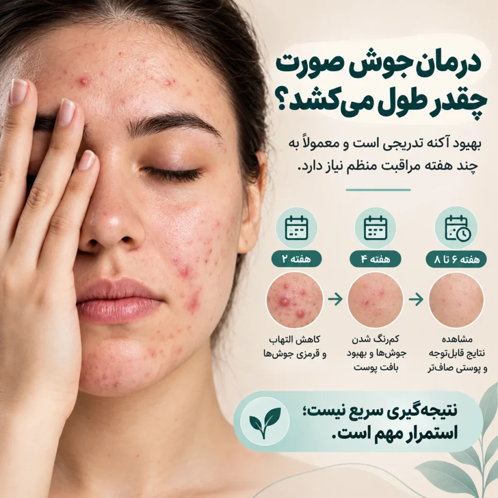 درمان جوش صورت؛ علت جوش، بهترین روش‌های درمان و محصولات ضدجوش