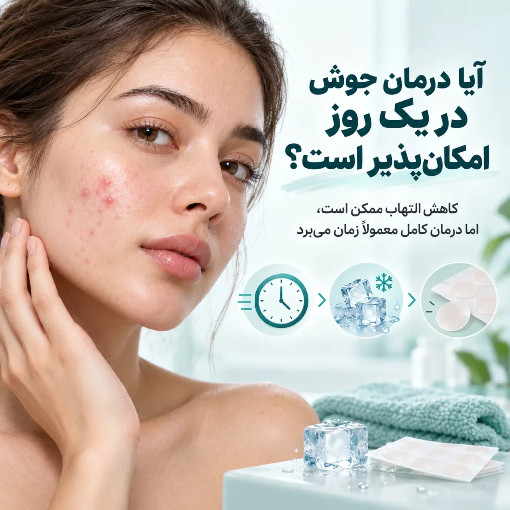درمان جوش صورت؛ علت جوش، بهترین روش‌های درمان و محصولات ضدجوش