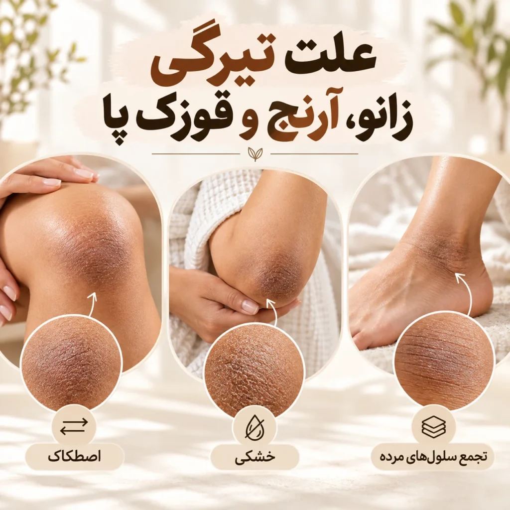 رفع تیرگی بدن؛ علت سیاهی پوست و بهترین روش‌های روشن شدن زانو، آرنج، قوزک پا و کشاله ران