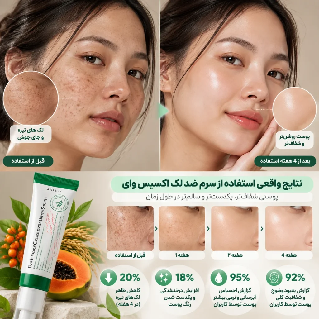 سرم ضد لک اکسیس وای Dark Spot Correcting Glow Serum حجم 50 میلی‌لیتر؛