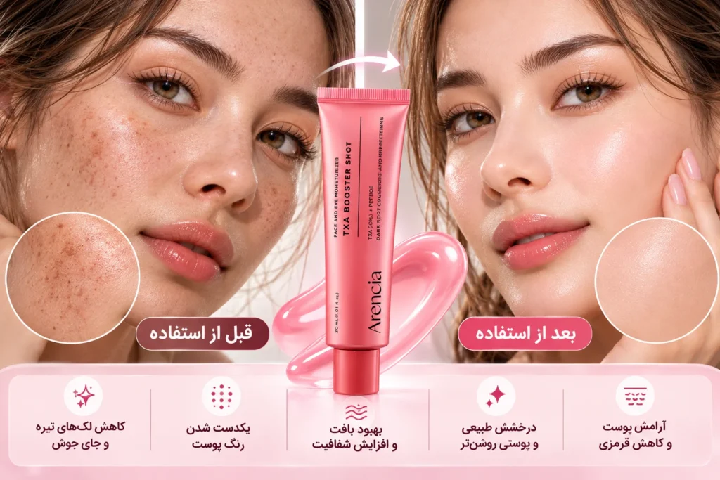 نتیجه 14