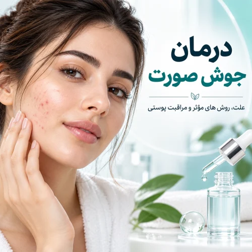 درمان جوش صورت؛ علت جوش، بهترین روش‌های درمان و محصولات ضدجوش